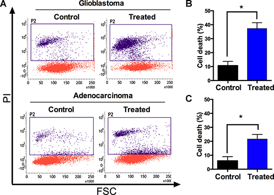 Metallacycle 4 induced cell death in glioblastomaand adenocarcinoma.