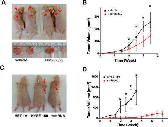 Reduction of SOCE by channel blocker or knockdown of Orai1 prevented tumor growth in xenograft nude mice.