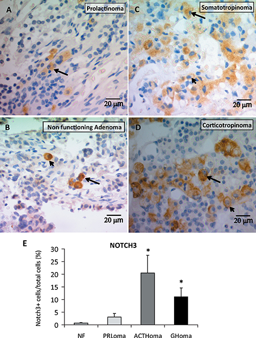 NOTCH3 protein expression determined by immunohistochemistry.