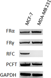 Folate transporters in MTX-sensitive and MTX-resistant human breast cancer cell lines.