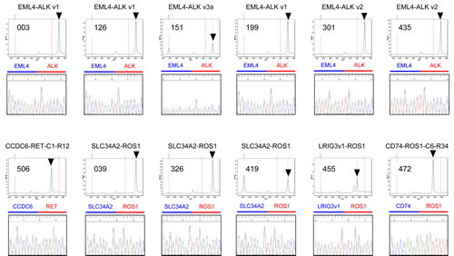 Detection of ALK, RET, and ROS1 fusion genes in FFPE specimens of advanced NSCLC.