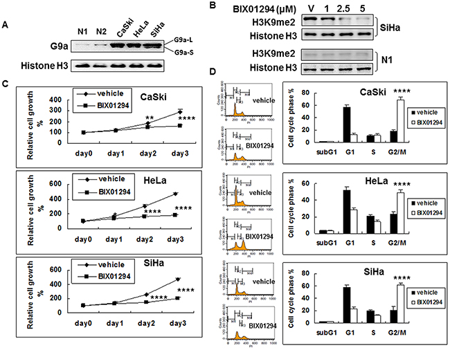 G9a expression in cervical cancer cells and the anti-cell proliferation effect of G9a chemical inhibitor BIX01294.