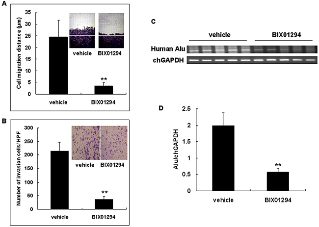 G9a inhibitor BIX01294 inhibits cervical cancer cell migration and invasion.