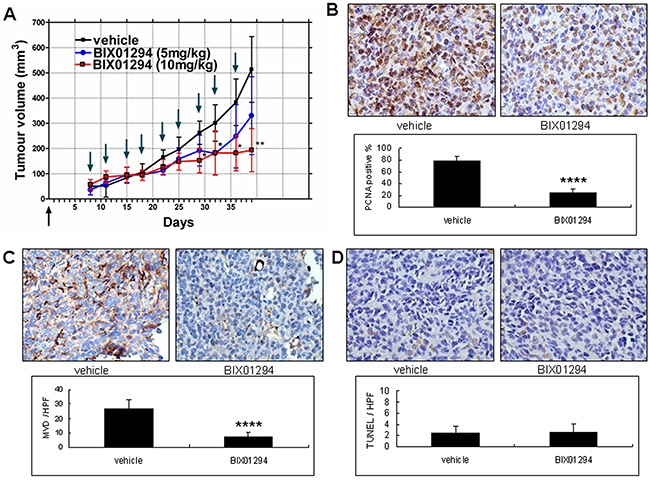 Effect of BIX01294 on the tumor growth curve of SiHa cells.