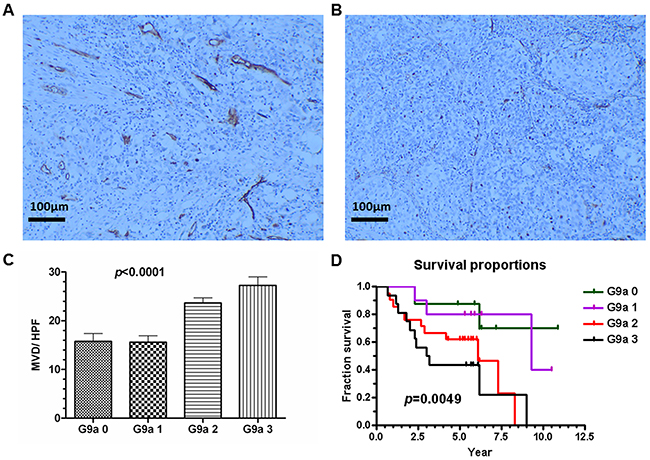 G9a expression correlates with microvessel density (MVD) and with poor clinical survival rate.