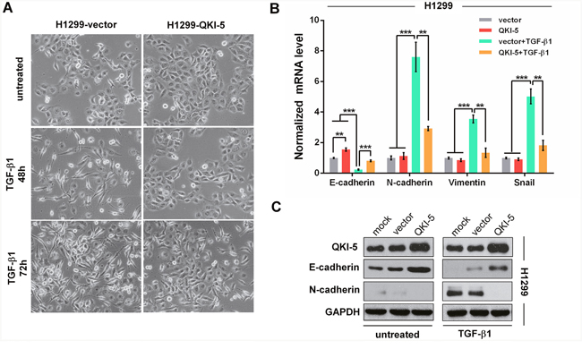 QKI-5 overexpression restrains the TGF-&#x03B2;1-induced EMT of LC cells.