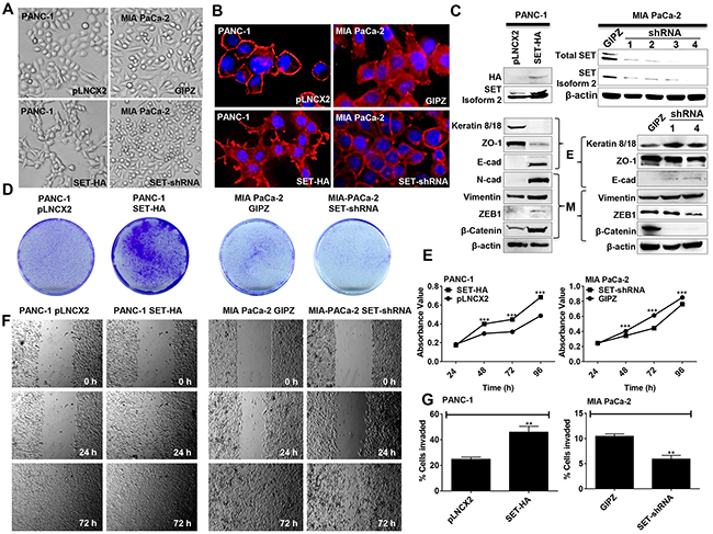 SET isoform 2 induces EMT and promotes growth, migration, and invasion of pancreatic cancer cells.