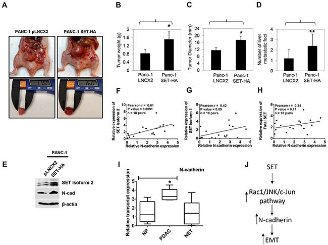 SET isoform 2 overexpression increased tumor growth and metastasis in orthotopic pancreatic cancer mice model.