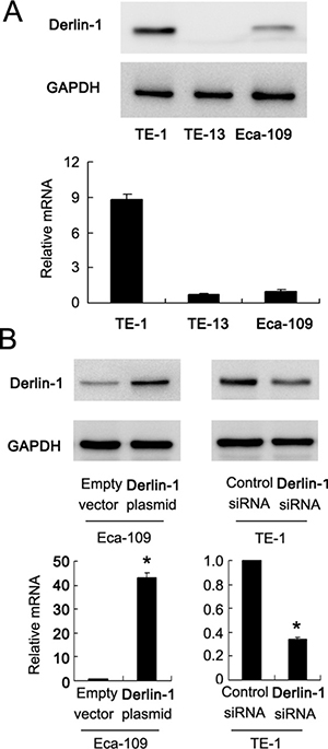 Expression of Derlin-1 in ESCC cell lines.