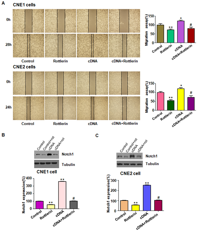 The expression of Notch-1 was measured in Notch-1 cDNA transfected nasopharyngeal carcinoma cells treated with rottlerin.