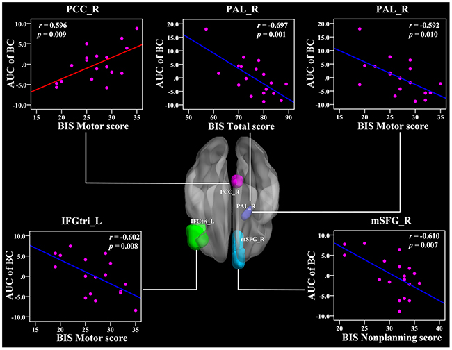 The Pearson correlation between the AUC of the nodal betweenness centrality with BIS-11 scores in CD group (p &#x003C; 1/90, uncorrected, controlling for the age, and mean FD).