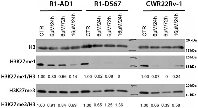 GSK-J4 treatment affects levels of H3K27 methylation.