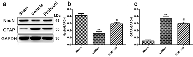 Probucol inhibits astrocytes activation and protects neurons after SCI in rat.
