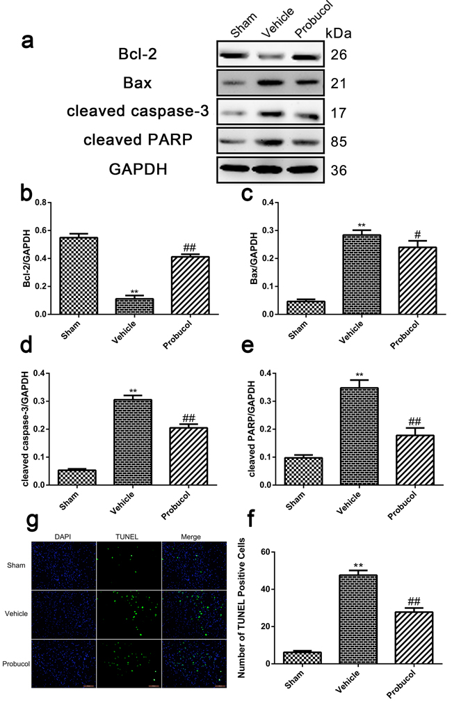 Probucol attenuates apoptosis caused by spinal cord injury in rat.