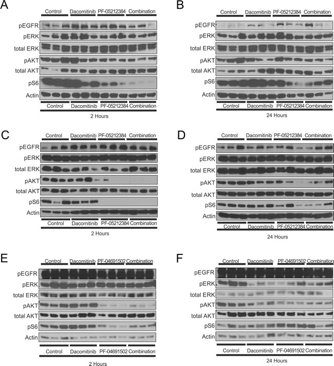 Western blot analysis of the indicated proteins in three independent tumors of the triple-negative breast cancer (TNBC),