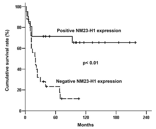 Overall survival curve of 46 patients with head and neck squamous cell carcinoma associated with NM23-H1 expression of primary tumors.