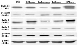 Western blot analysis of the protein levels of NM23-H1 and cyclin D1, E, A1, and B1 in the SAS head and neck squamous cell carcinoma clones.