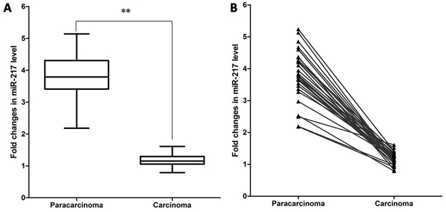 Expression of miR-217 in laryngeal cancer tissues.