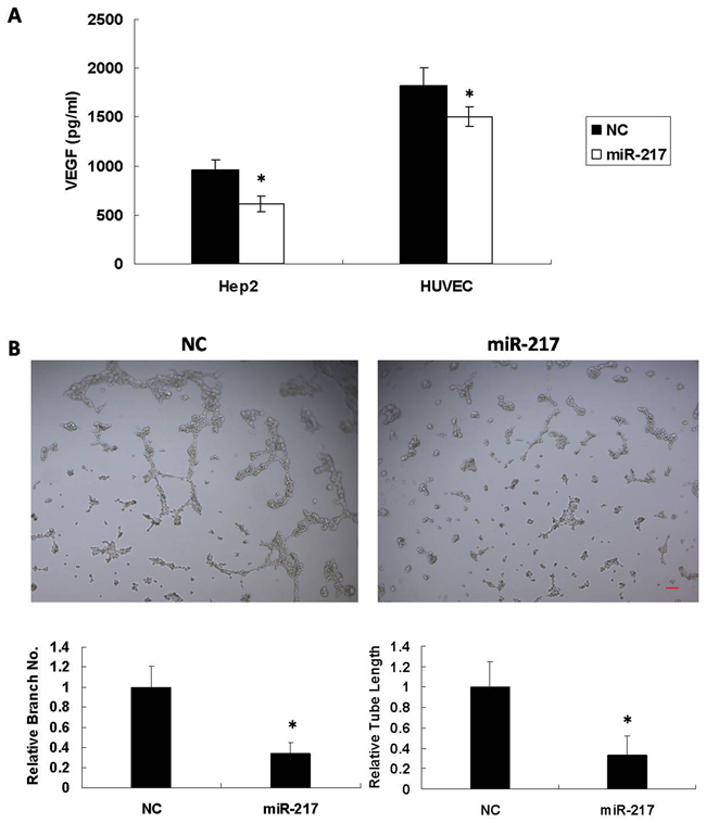 miR-217 inhibits angiogenesis.