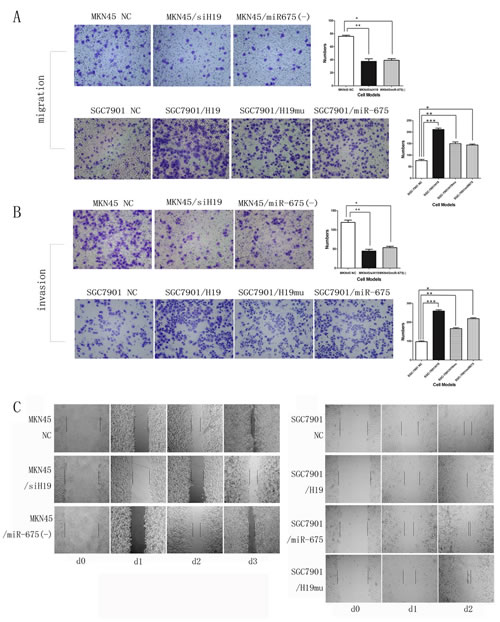 Fig3: H19/miR-675 promotes migration and invasion of MKN45 or SGC7901 cells based on transwell and wound-healing assay.
