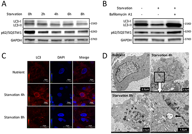 Autophagy is induced by starvation with EBSS in CMs.