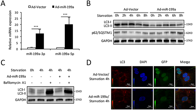 Overexpression of miR-199a blocks the autophagy activity in CMs.