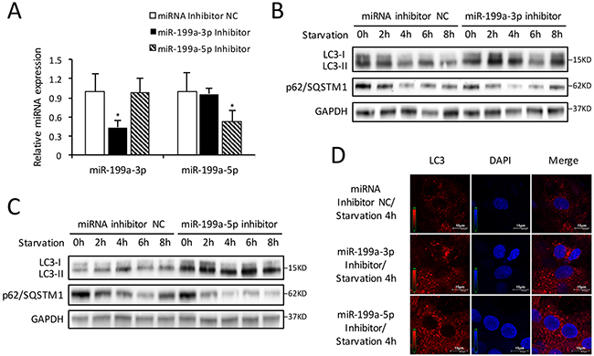 Inhibition of endogenous miR-199a stimulates autophagic activity.