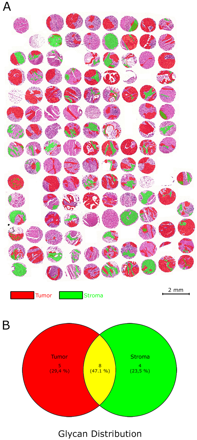 Regions of interests (virtual microdissection) separating tumor cells and tumor stroma.
