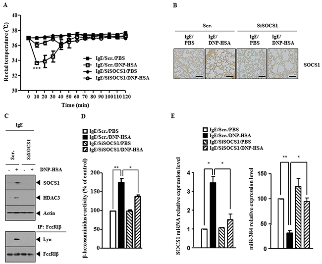 SOCS1 mediates passive systemic anaphylaxis (PSA).