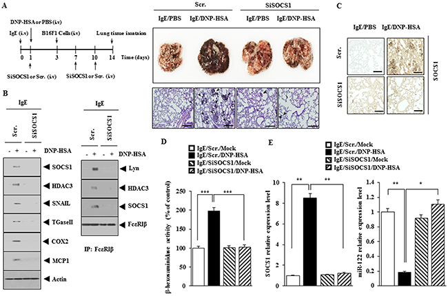 SOCS1 is necessary for the enhanced metastatic potential of cancer cells by allergic inflammation.