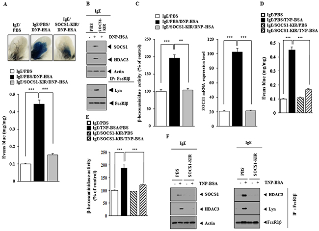 SOCS1-KIR mimetic peptide inhibits PCA.