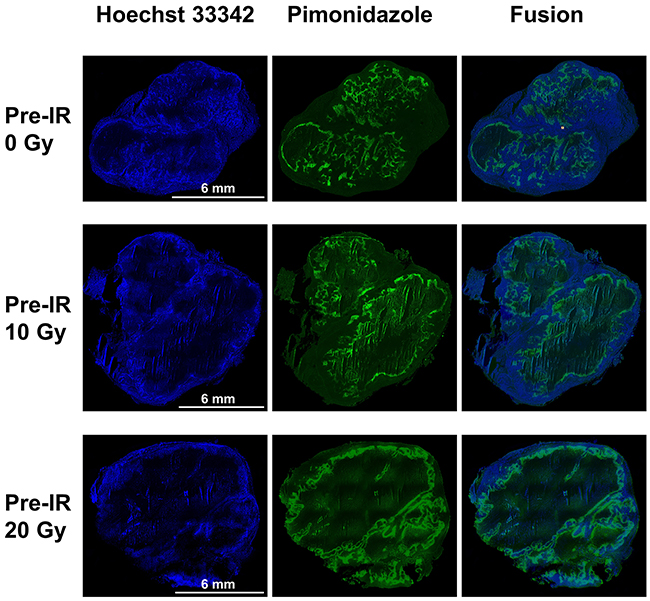 Pimonidazole, Hoechst 33342 and fusion images of tumors in the 0 Gy, 10 Gy and 20 Gy pre-irradiation models.
