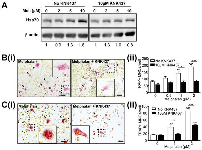 Enhancement of osteoclast formation caused by melphalan is reduced by HSP inhibitor KNK437.