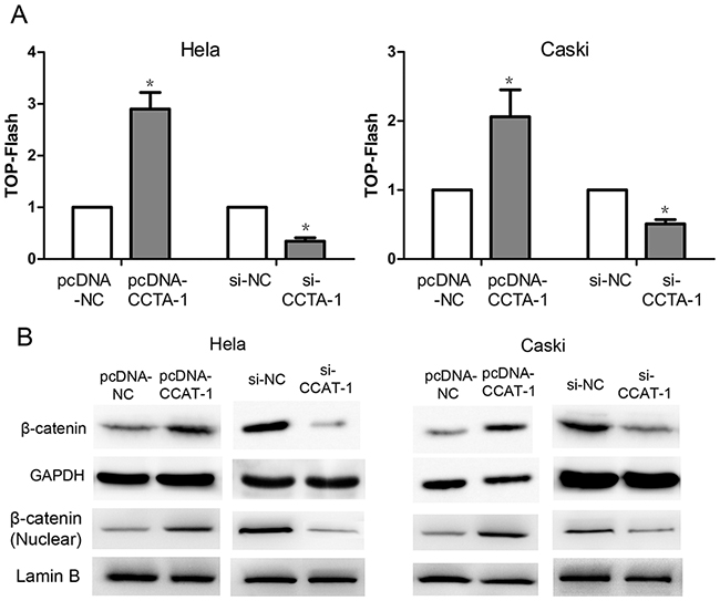 The regulation of Wnt pathway by CCAT-1.