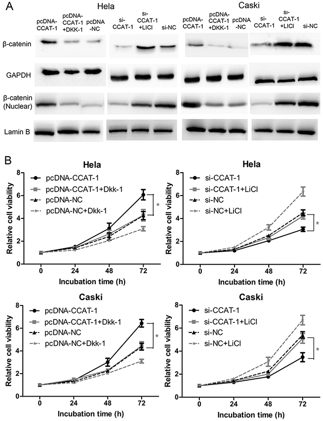 CCAT-1 achieved its biological functions via regulating Wnt pathway.