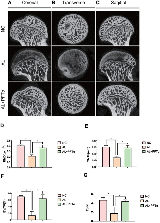 Alcohol-induced ONFH was alleviated with PFT&#x03B1; treatment by Micro-CT analyses.