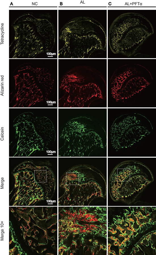 The blockage effect of PFT&#x03B1; against alcohol-induced anti-osteogenesis rat femoral head.