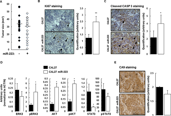 Effect of miR-223-3p on tumor biology.