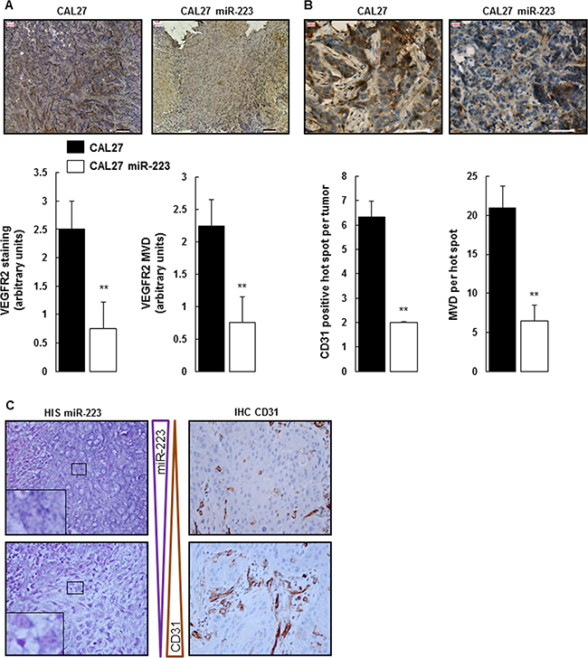miR-223-3p inhibited neoangiogenesis.