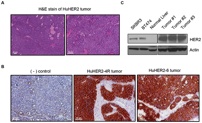 Characterization of spontaneous tumors derived from HuHER2 transgenic mice.