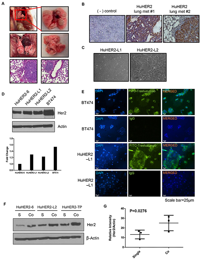 Characterization of spontaneous lung metastases in HuHER2 transgenic mice and establishment of HuHER2-Lung metastasis cell lines overexpressing human HER2.