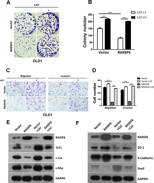 RASSF6 inhibits the tumorigenesis of colorectal cancer through the Wnt signalling pathway.