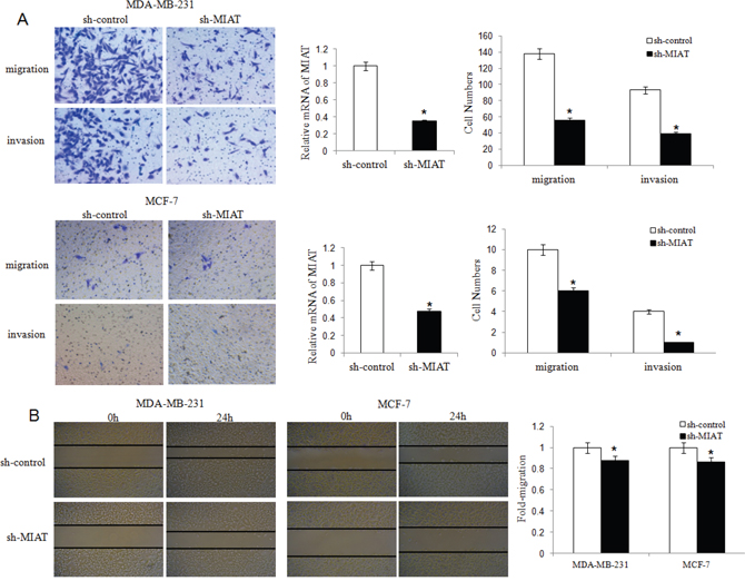 MIAT downregulation inhibited migration and invasion of MDA-MB-231 and MCF-7 breast cancer cells.