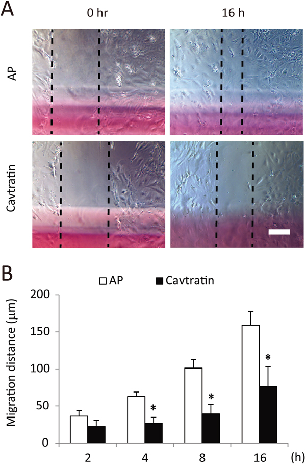 Cavtratin inhibits the migration of endothelial cells.