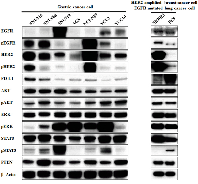 Association of PD-L1 expression with the EGFR/HER2 signaling pathway in gastric cancer cell lines.