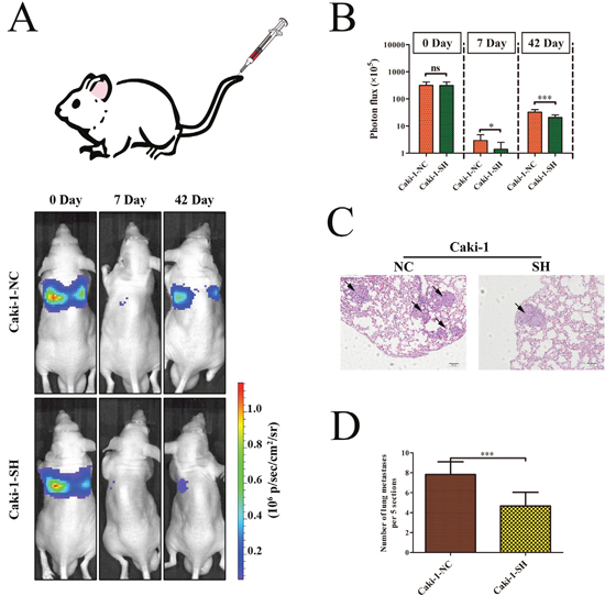 KRT8 promotes ccRCC metastasis in vivo.