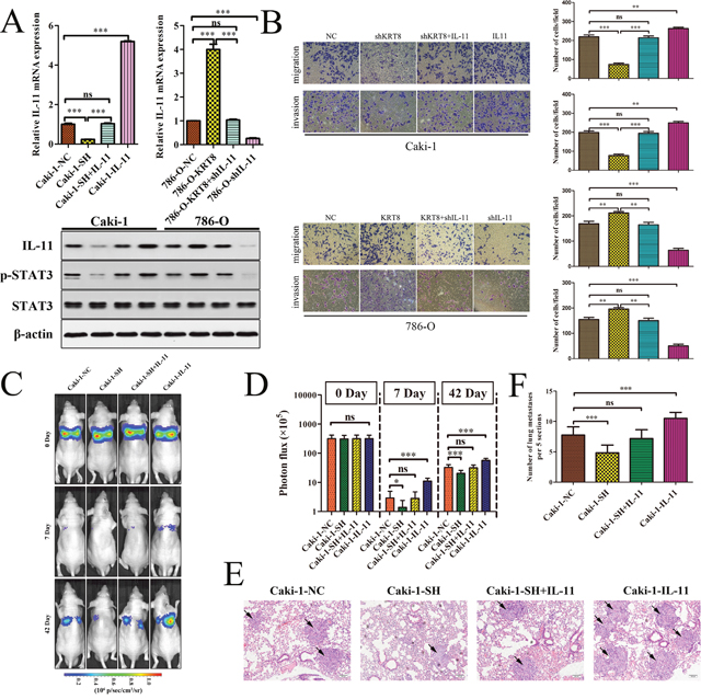 KRT8 is required for the IL-11-mediated metastatic phenotype in ccRCC.