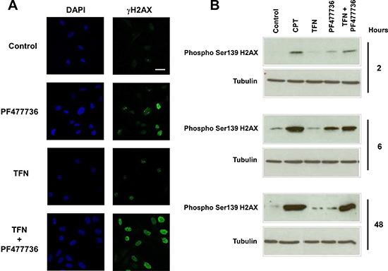 The combination of teriflunomide and PF477736 induces H2AX phosphorylation on serine 139 (&#x03B3;H2AX) in SUM159 triple negative breast cancer cell line.