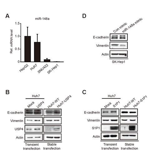 The effect of miR-148a, USP4, and S1P1 on the expression of EMT markers.