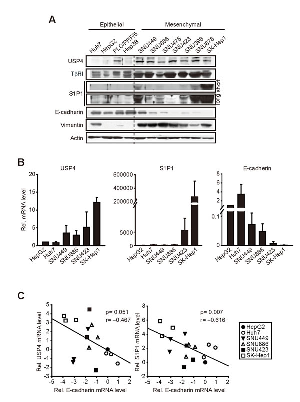 Comparisons of USP4, S1P1 and E-cadherin levels in liver-tumor cell lines.